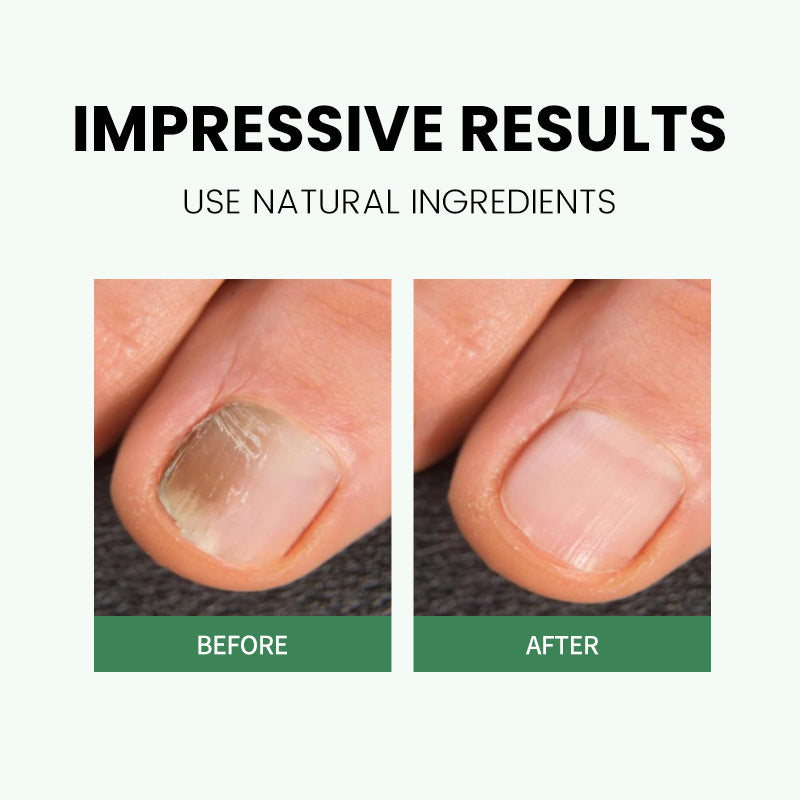 Nail Art Rotating Finger Pen Nutrition Oil Moisturizing Anti-dead Barbed Nail Polish